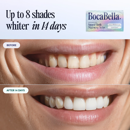 Natural Teeth Whitening Strips